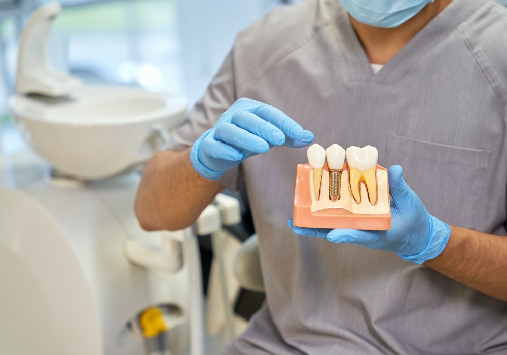 Mondzorg Jekerdal Implantaten