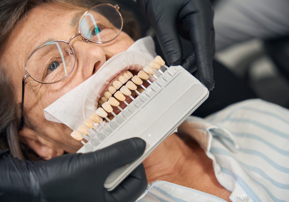 Specialist selects the color of dental crown for patient